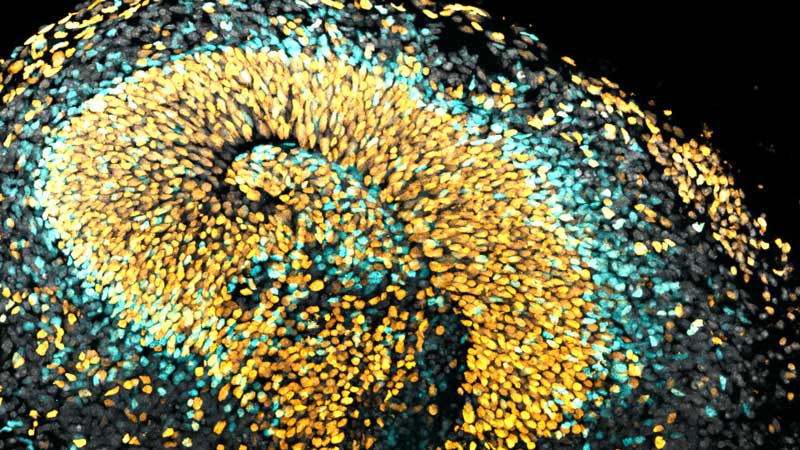 A microscopy picture. Thousands of small, luminous, oval-shaped points in yellow, turquoise, and grey are densely packed against a black background. These points are arranged in sweeping, curved paths that create the appearance of overlapping, folded layers or swirling waves.
