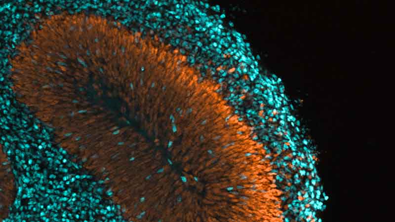 A microscopy picture. On a black background, a large fan-shaped structure is composed of thousands of elongated, orange oval shapes radiating outward from a central line. This orange area is surrounded and partially covered by a dense layer of smaller, bright turquoise circular points. The entire arrangement occupies the left and center of the frame, tapering off into dark space on the right.